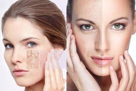 20170603170356903.jpg 20170603170356903.jpg