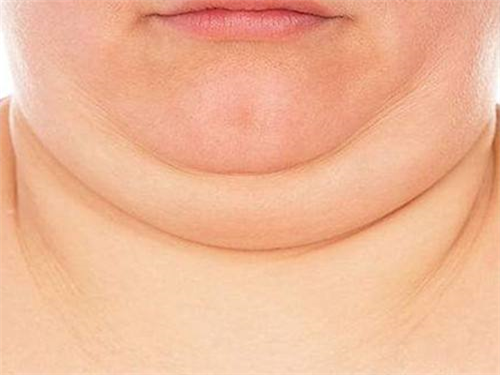 image003.png image003.png