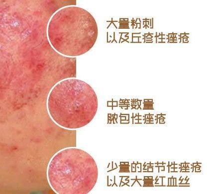 下载.jpg 下载.jpg