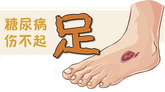 v2-766c3121f68f15de07641eec50903286_1440w.jpg v2-766c3121f68f15de07641eec50903286_1440w.jpg