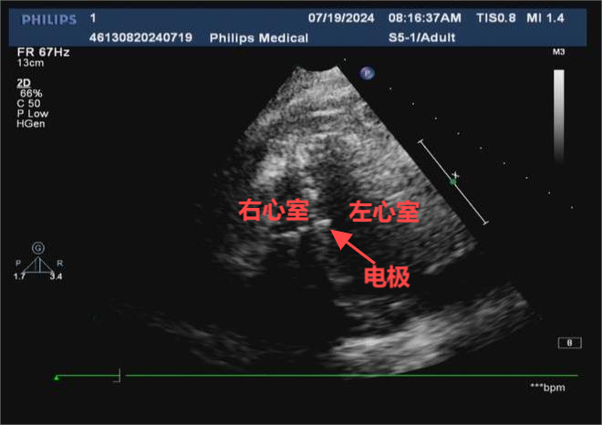 image007.png image007.png