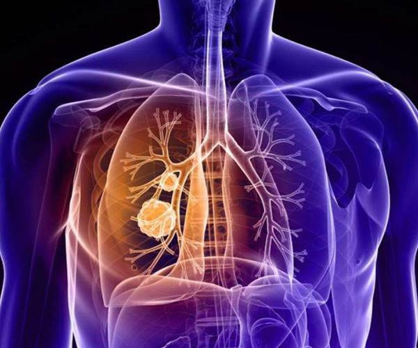 t0141fbe145ff953c72.jpg t0141fbe145ff953c72.jpg