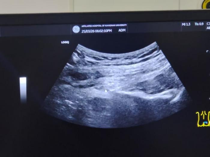 两年“痛魔”纠缠不休，三甲医院为“难言之隐”松绑1 (1).jpg