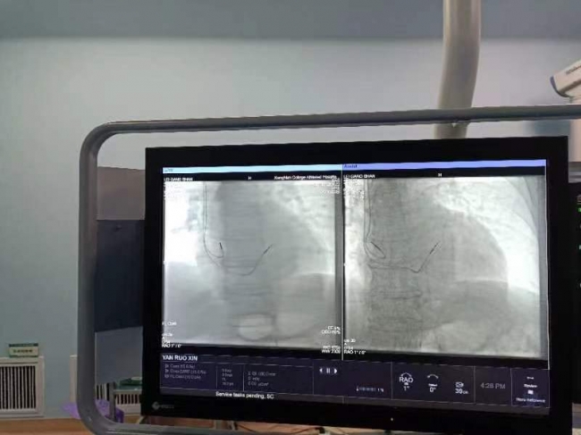 为患者节省2.6万元！